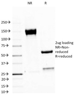 MUC1 Antibody (MUC1/520), Novus Biologicals 0.2mg; Unlabeled:Antibodies,
